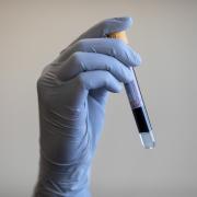 In a central alert released on Thursday, NHS England alerted to a supply issue with blood test tubes (PA)
